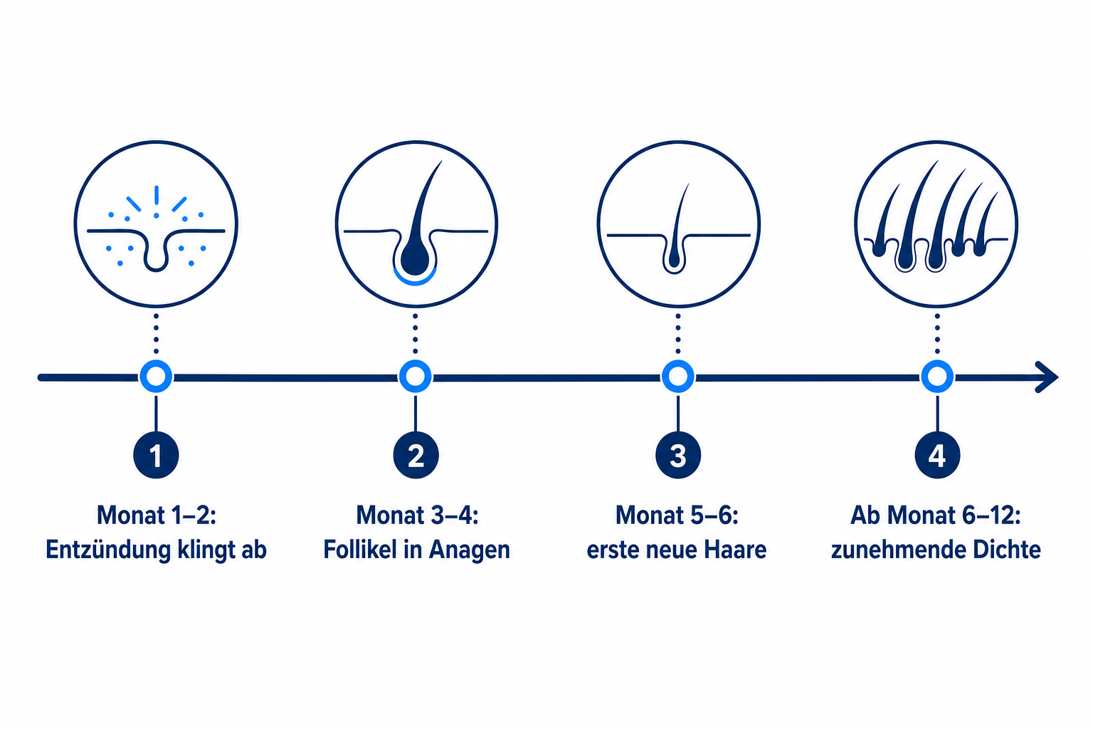 Timeline: Nachwachsen der Haare nach erfolgreicher Kortison-Therapie über zwölf Monate