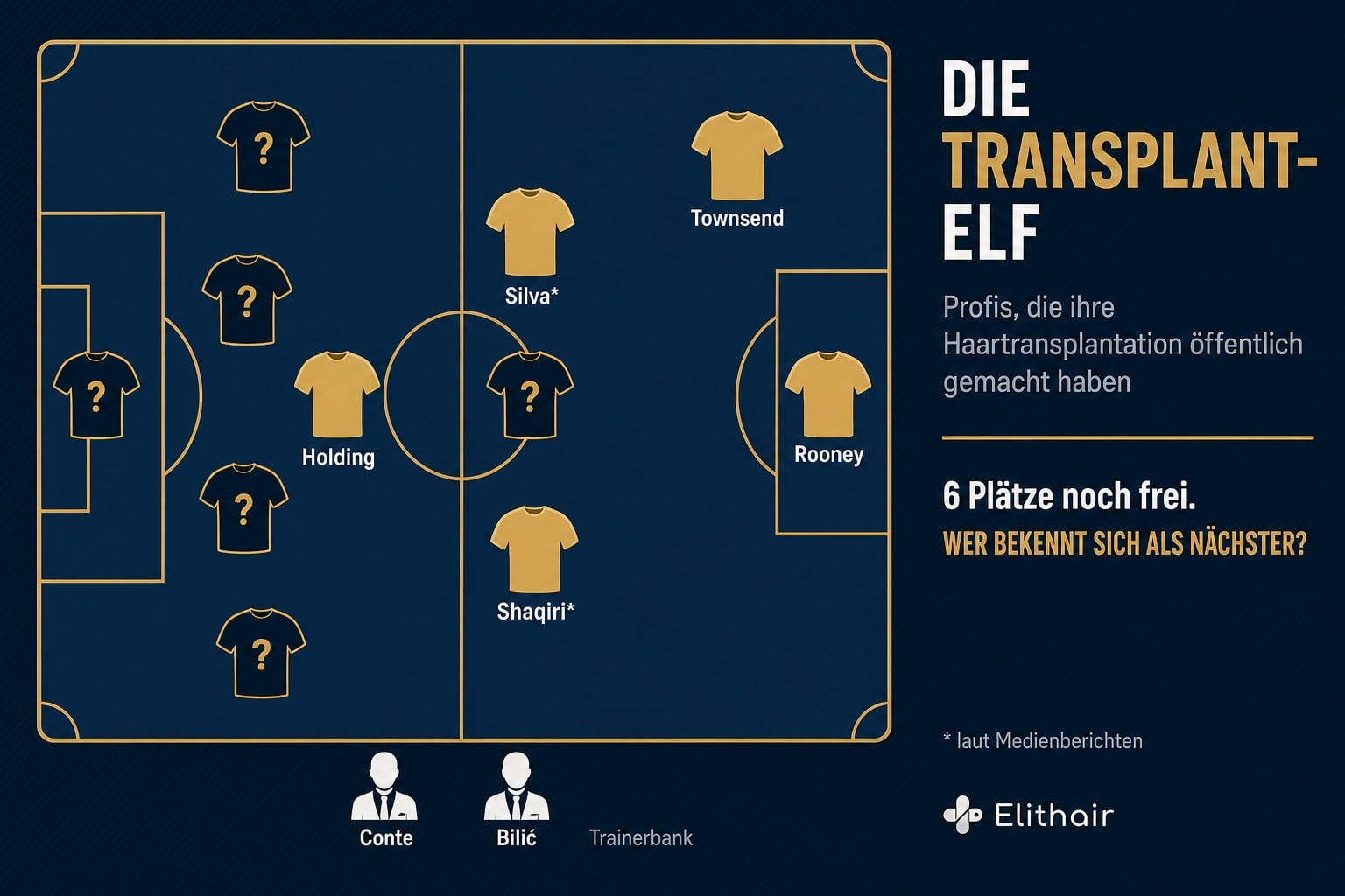 Infografik: Die Transplant-Elf, Profis mit öffentlich gemachter Haartransplantation auf der Taktiktafel
