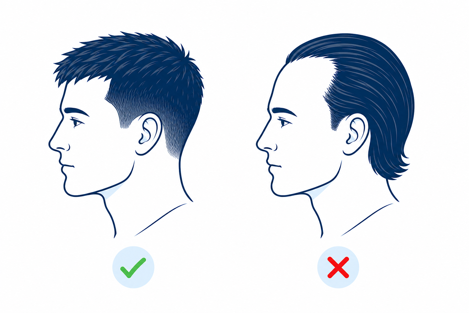 Illustrierter Vergleich zweier Herrenfrisuren, die Geheimratsecken kaschieren oder betonen
