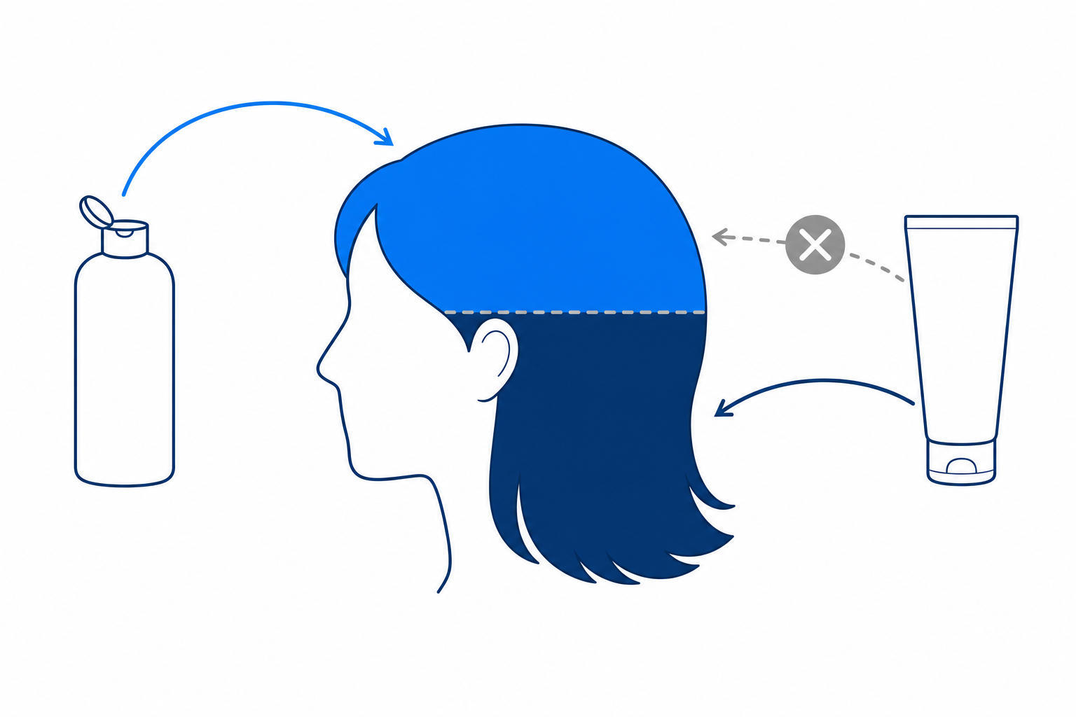 Illustration: Kopf im Profil mit markierter Kopfhautzone für das Wirkstoff-Shampoo und markierten Längen und Spitzen für die Pflege, Pflege am Ansatz durchgestrichen