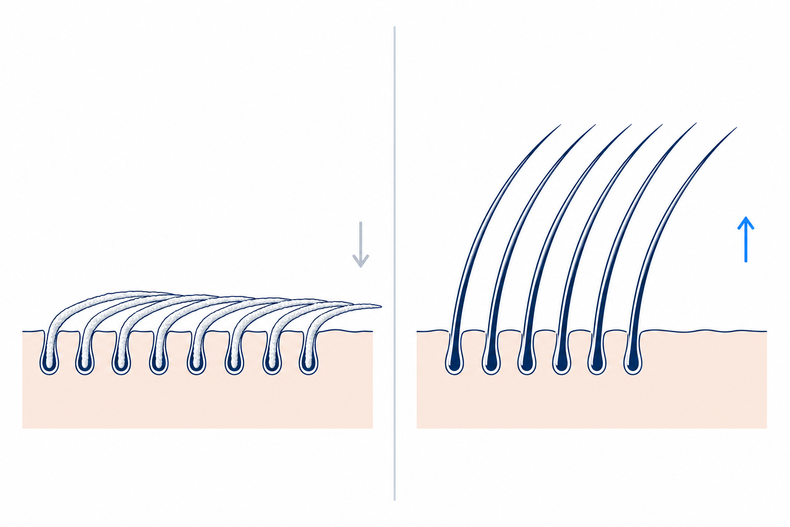 Illustration: feines Haar liegt durch den Kalkfilm platt am Ansatz an, nach einem Klär-Schritt richtet es sich wieder auf