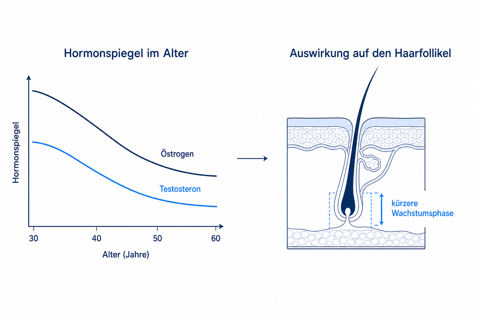 Infografik: sinkende Östrogen- und Testosteronspiegel und ihre Wirkung auf den Haarfollikel im Alter