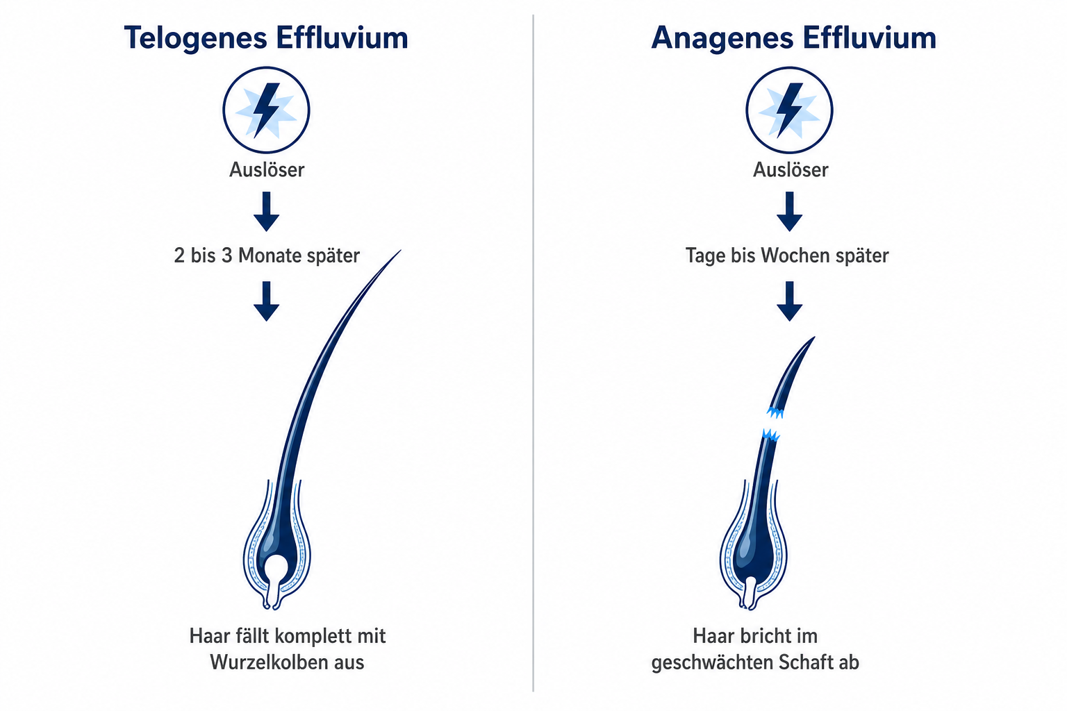 Infografik: telogenes Effluvium mit Wurzelkolben gegenüber anagenem Effluvium mit abgebrochenem Haarschaft