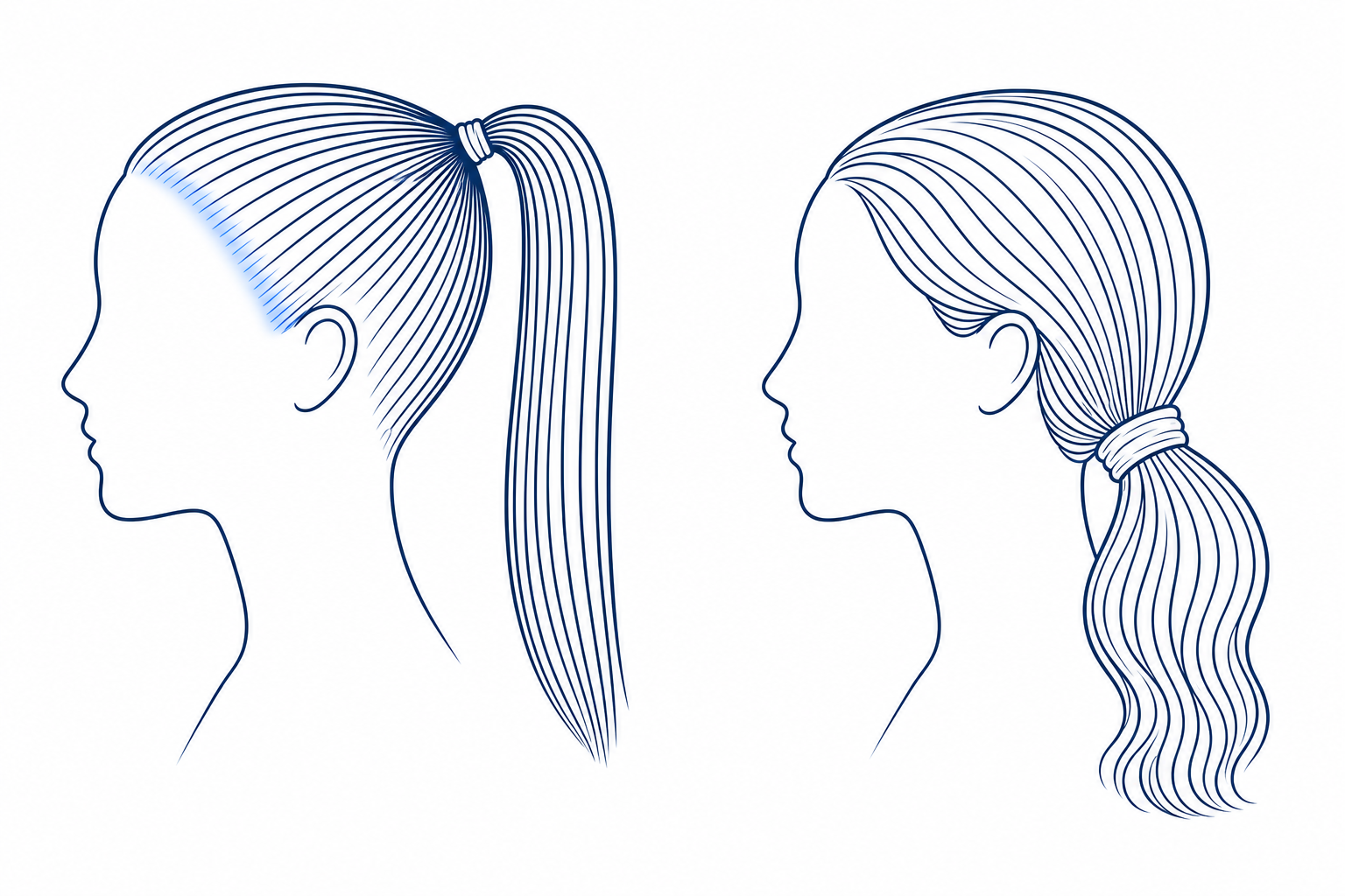 Schematischer Seitenvergleich zweier Frisuren: links ein straff gebundener hoher Zopf mit sichtbar gespanntem Haaransatz, rechts ein locker sitzender tiefer Zopf ohne Zug am Haaransatz