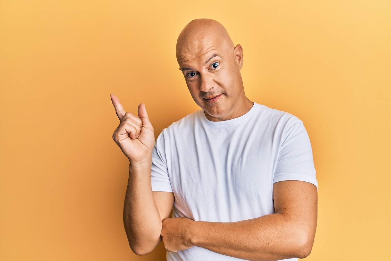 Un hombre con alopecia avanzada