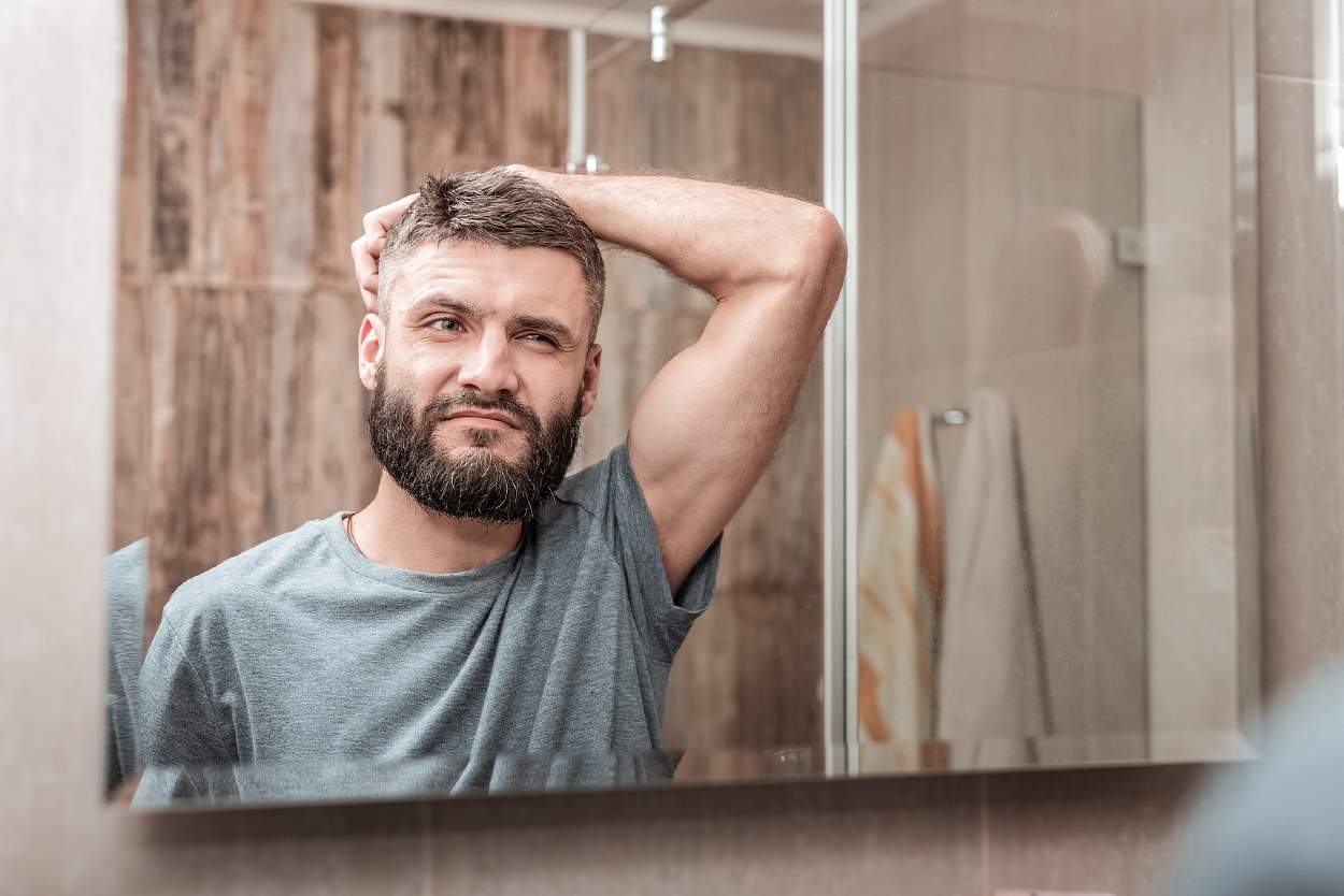 Causas de la calvicie en los hombres