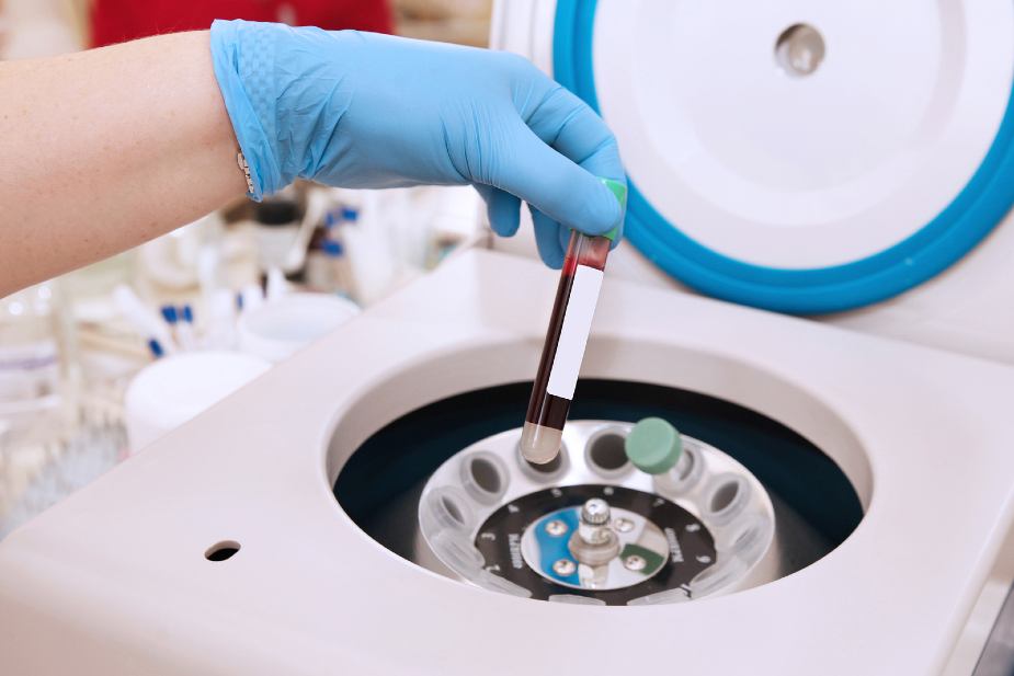Centrifugadora de plasma para el vampire lifting