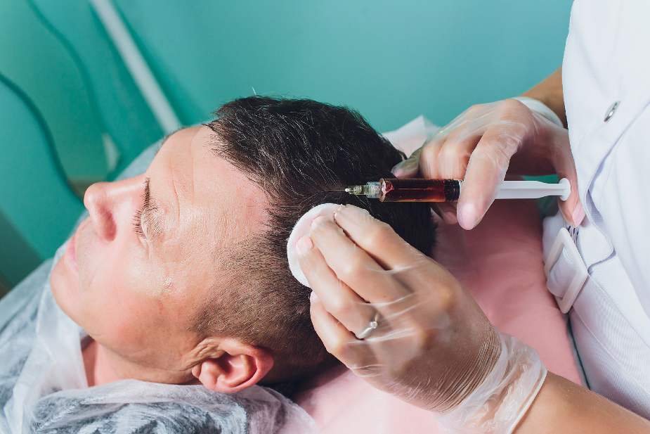 Hombre recibiendo inyecciones de plasma en la cabeza