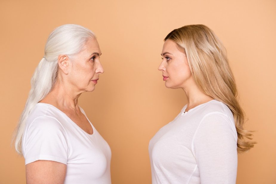 Dos mujeres de diferente edad con diferentes posibilidades de ser candidatas a un injerto capilar.