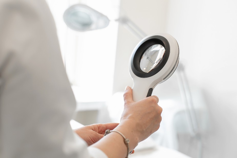 Tricólogo sosteniendo un dermatoscopio para observar las unidades foliculares en el cuero cabelludo.