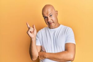 Un hombre con alopecia avanzada
