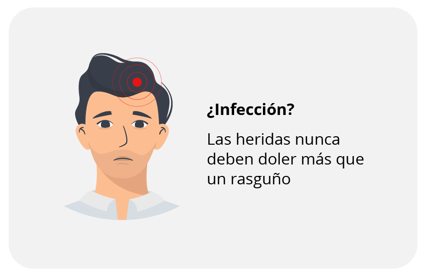 Riesgos de los injertos capilares: infección.