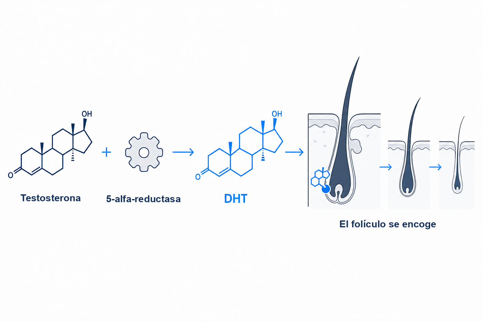 How testosterone converts to DHT and shrinks hair follicles