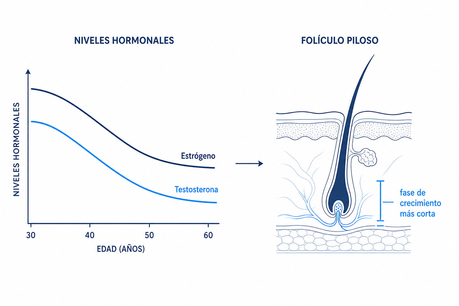 Infografía: descenso de los niveles de estrógeno y testosterona y su efecto sobre el folículo piloso con la edad