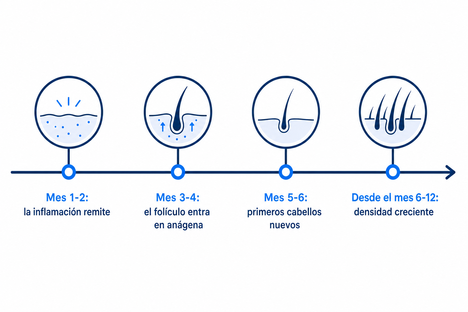 Cronología: el cabello vuelve a crecer tras una terapia con cortisona eficaz a lo largo de doce meses