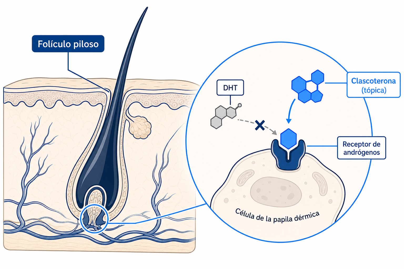 Ilustración: la clascoterona bloquea el receptor de andrógenos en el folículo piloso y desplaza al DHT