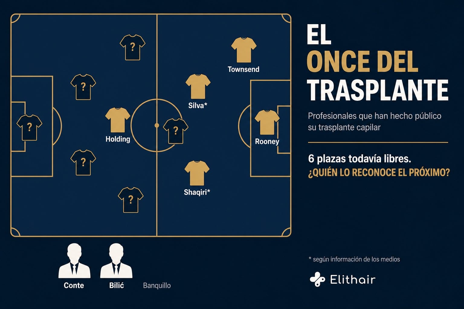 Infografía: el Once del Trasplante, profesionales con un trasplante capilar hecho público en la pizarra táctica