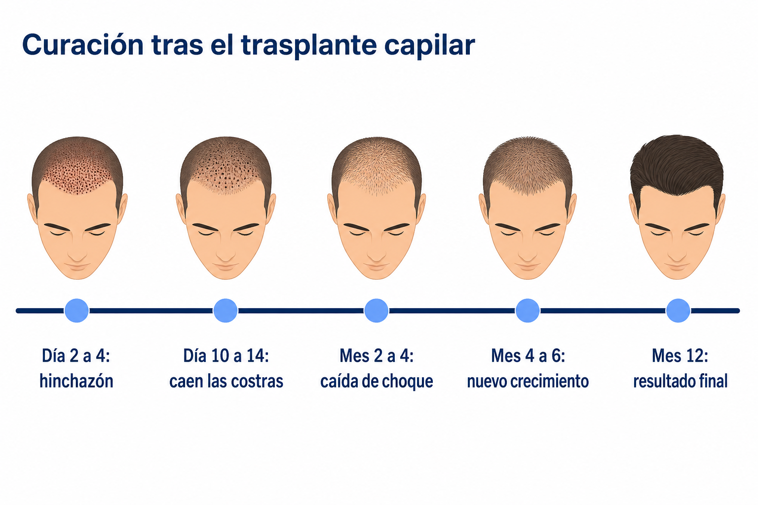 Línea temporal de la curación después del trasplante capilar, del día 2 al mes 12