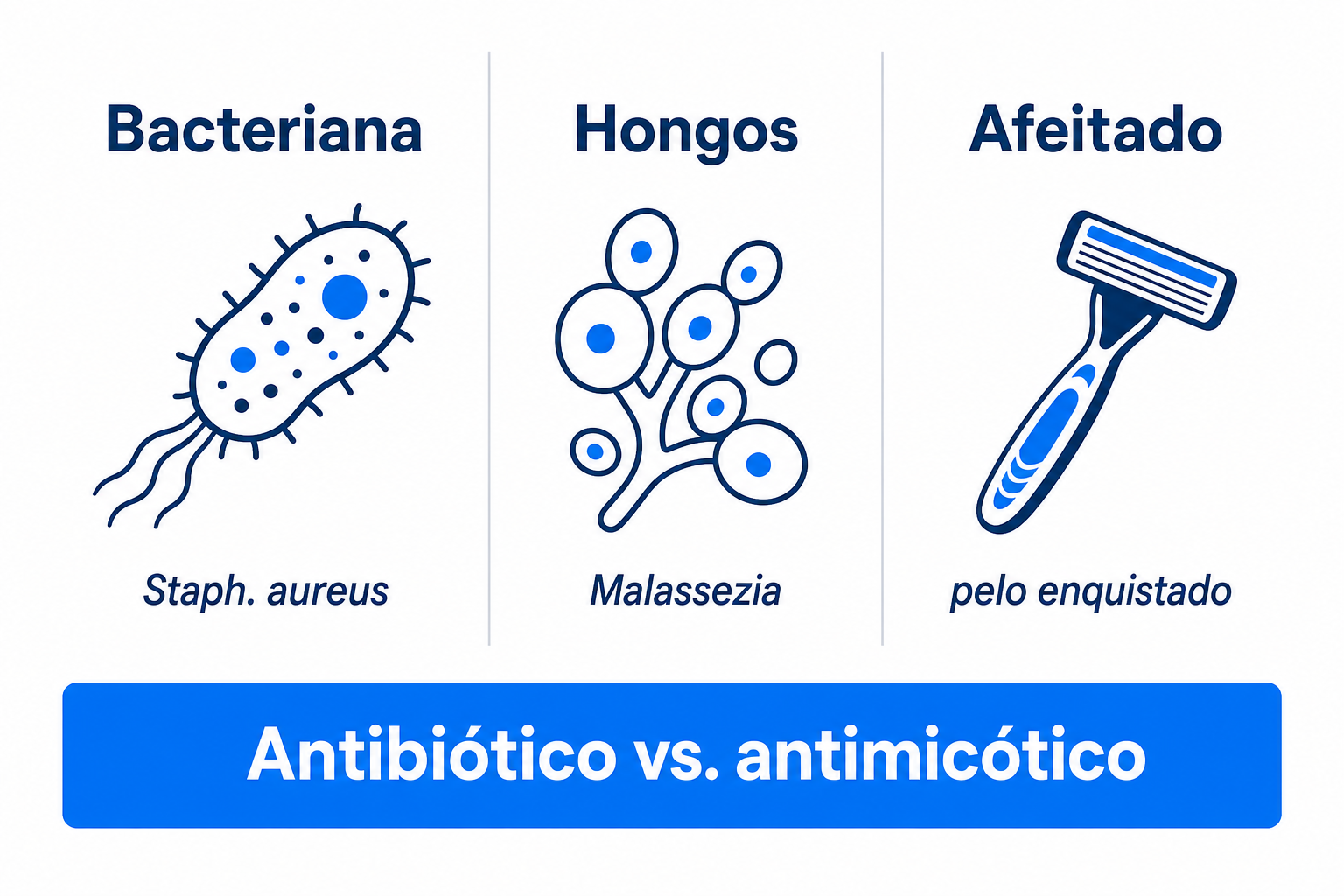 Comparación de los tres tipos más frecuentes de foliculitis: bacteriana, por hongos y por afeitado