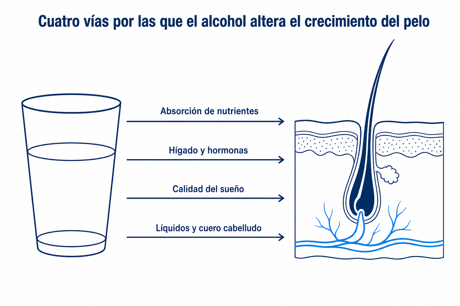 Infografía: cuatro vías por las que el alcohol altera el crecimiento del pelo, desde la absorción de nutrientes hasta el cuero cabelludo