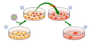 La greffe de cheveux effectuée avec des cellules souches
