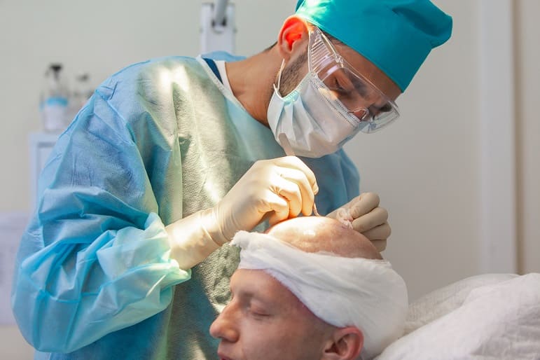 la greffe de cheveux pour traiter une alopécie liée à la thyroïde