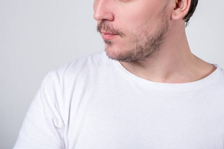 Photo d'un homme avec une barbe clairsemée