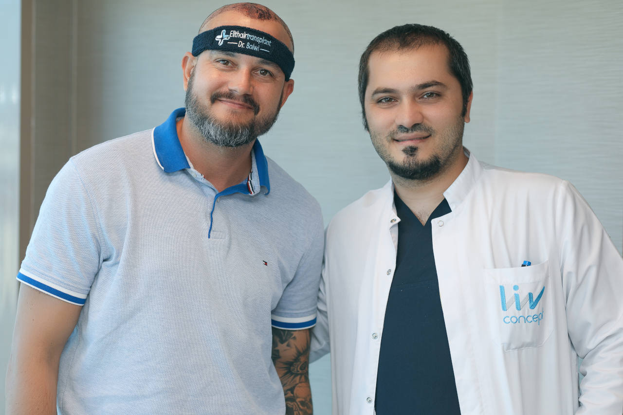 Ilustration patient après une greffe capillaire chez Elithair avec Dr Balwi