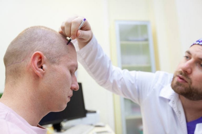 Image d'un medecin cherche la meilleure méthode pour traiter la pelade