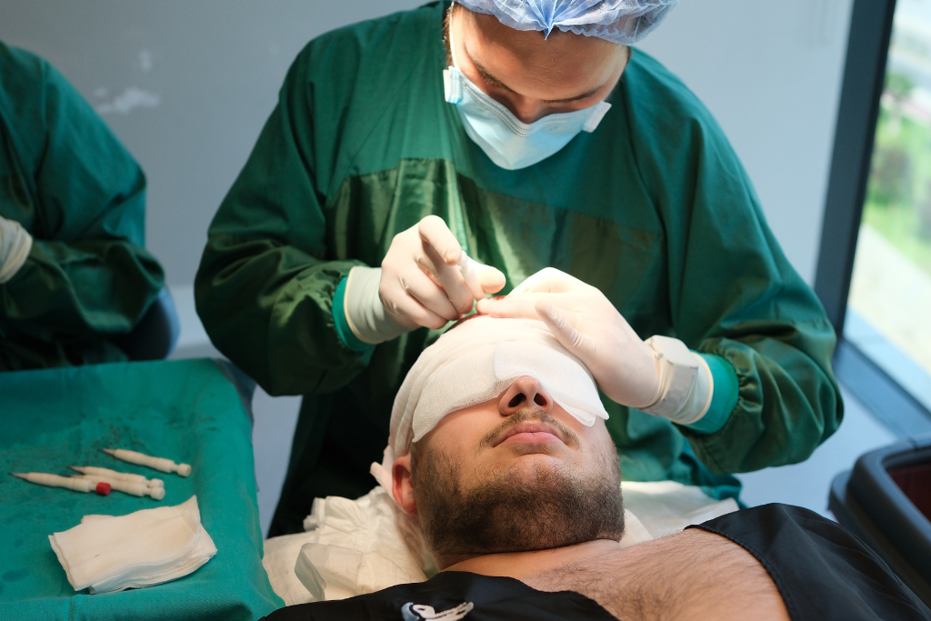 Patient Elithair faisant une greffe de cheveux