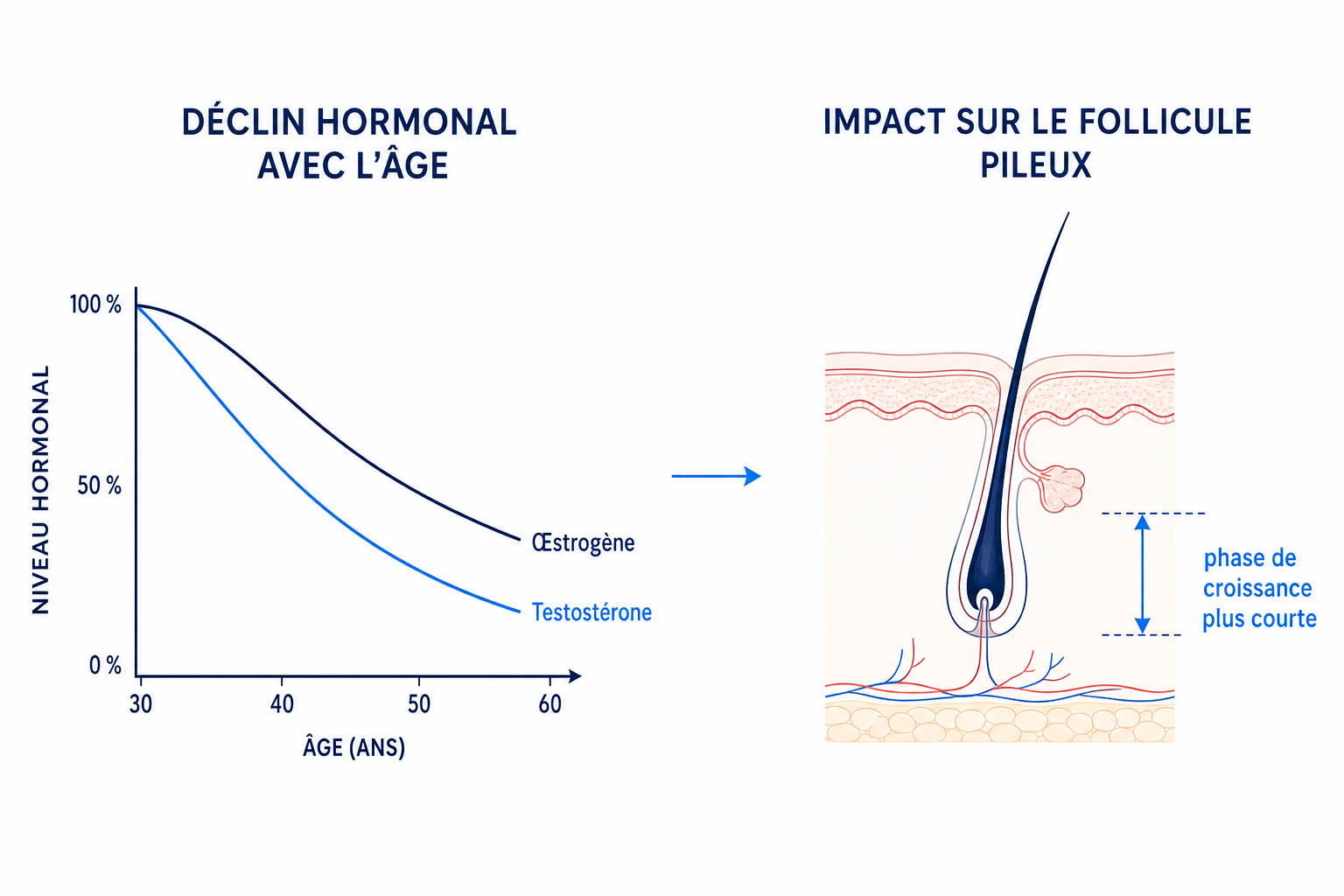 Infographie : baisse des taux d'œstrogène et de testostérone et leur effet sur le follicule pileux avec l'âge