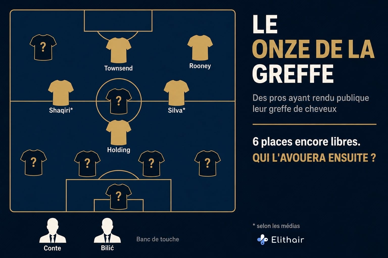 Infographie : le Onze de la greffe, des pros ayant rendu publique leur greffe de cheveux sur le tableau tactique