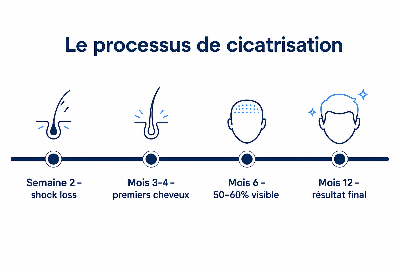 Processus de cicatrisation après une greffe de cheveux, du shock loss au résultat final après douze mois