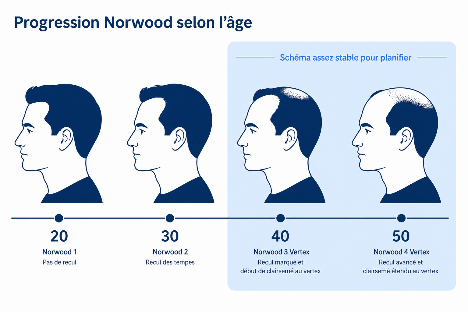 Frise chronologique de la progression Norwood : la chute de cheveux avance avec l'âge