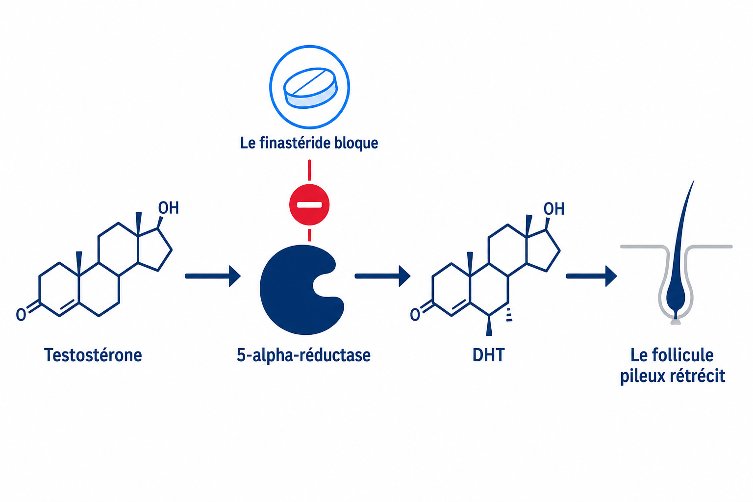 Schéma du mécanisme d'action du finastéride : le finastéride bloque la 5-alpha-réductase et abaisse la DHT