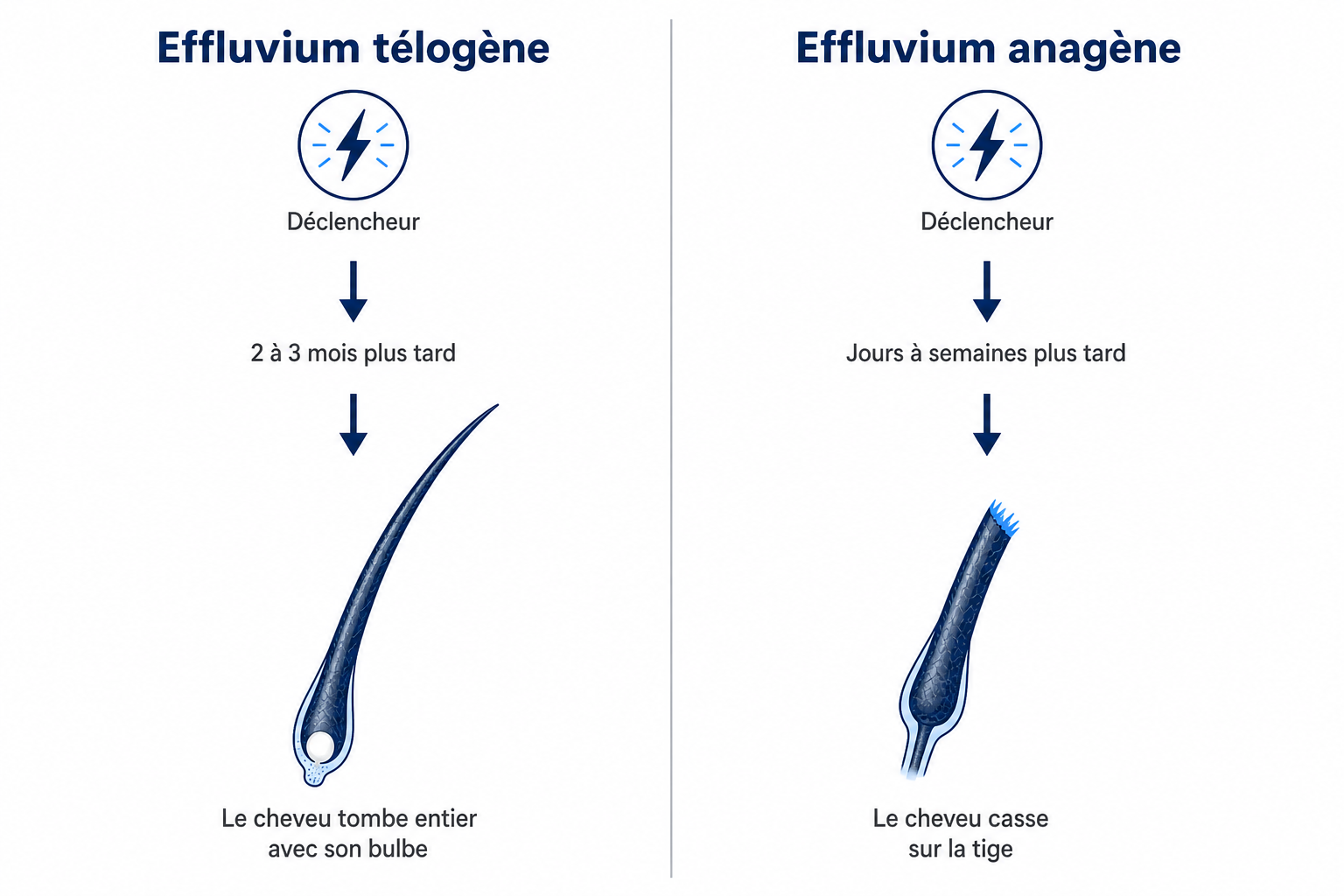 Infographie : effluvium télogène avec bulbe en massue comparé à l'effluvium anagène avec tige capillaire cassée