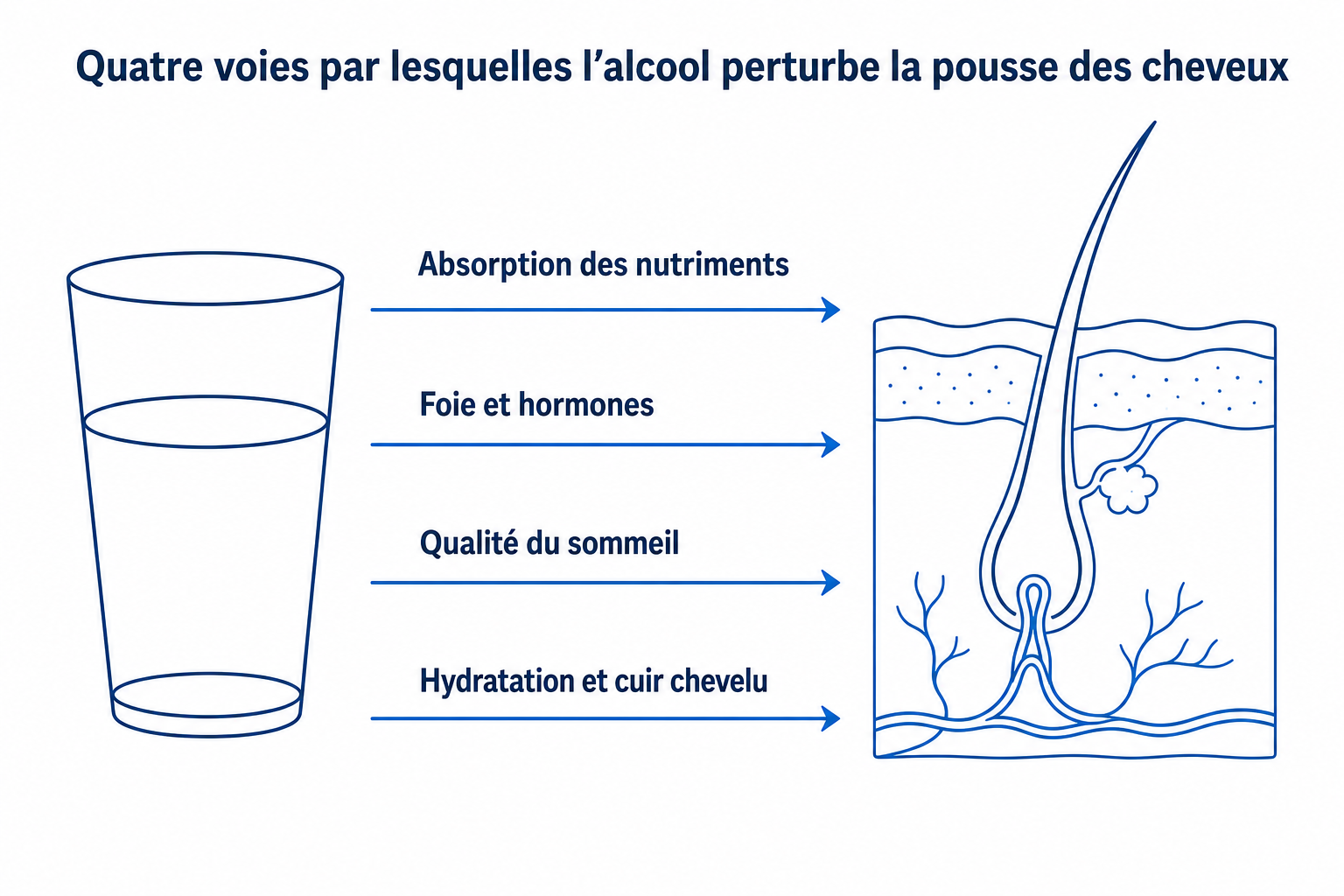 Infographie : quatre voies par lesquelles l'alcool perturbe la pousse des cheveux, de l'absorption des nutriments au cuir chevelu