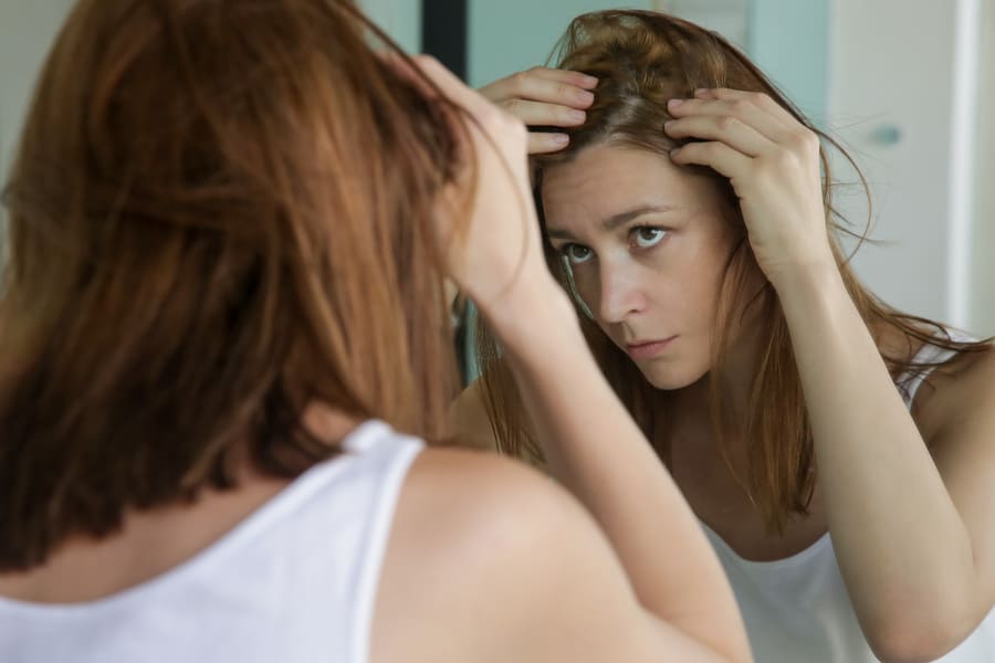 una giovane donna che soffre di calvizie femminile