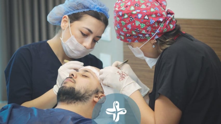i capelli trapiantati ricrescono dopo 6 mesi