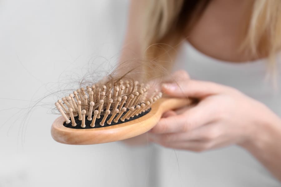 il trapianto di capelli per donne è l'unico modo di sconfiggere l'alopecia femminile