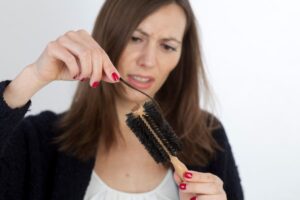 una donna ha perso i capelli a ciocche a causa dei farmaci