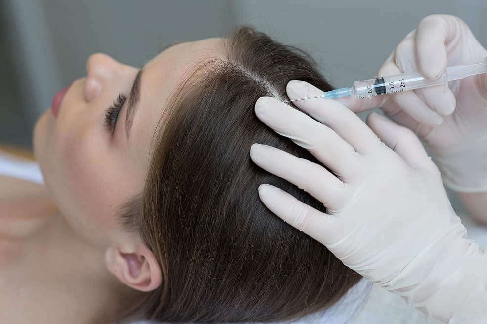 donna fa un trattamento di mesoterapia capelli