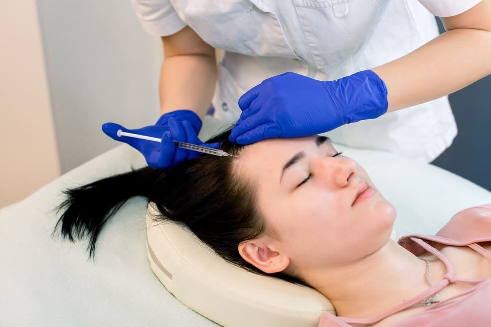 iniezione di mesoterapia per capelli