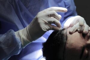 un paziente mentre effettua un trapianto di capelli senza rasatura