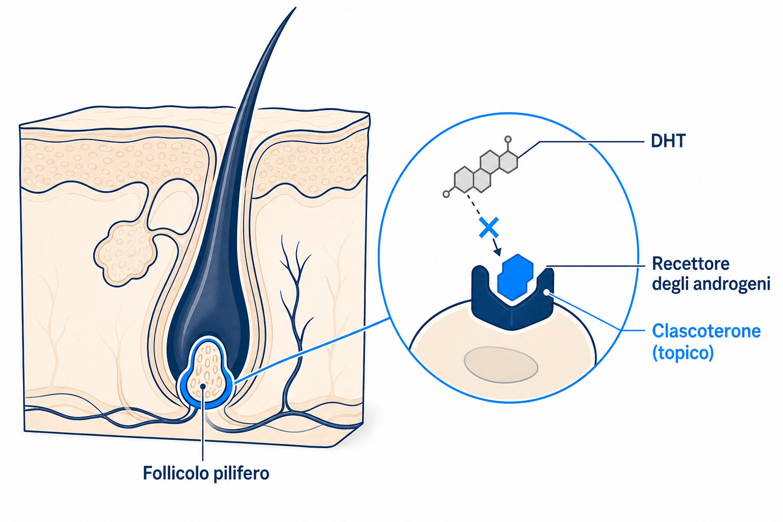 Illustrazione: il clascoterone blocca il recettore degli androgeni nel follicolo pilifero e scalza il DHT
