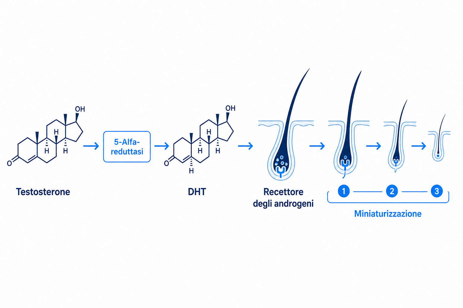 Diagramma del meccanismo del DHT: testosterone, 5-alfa-reduttasi, DHT e miniaturizzazione del follicolo della tempia