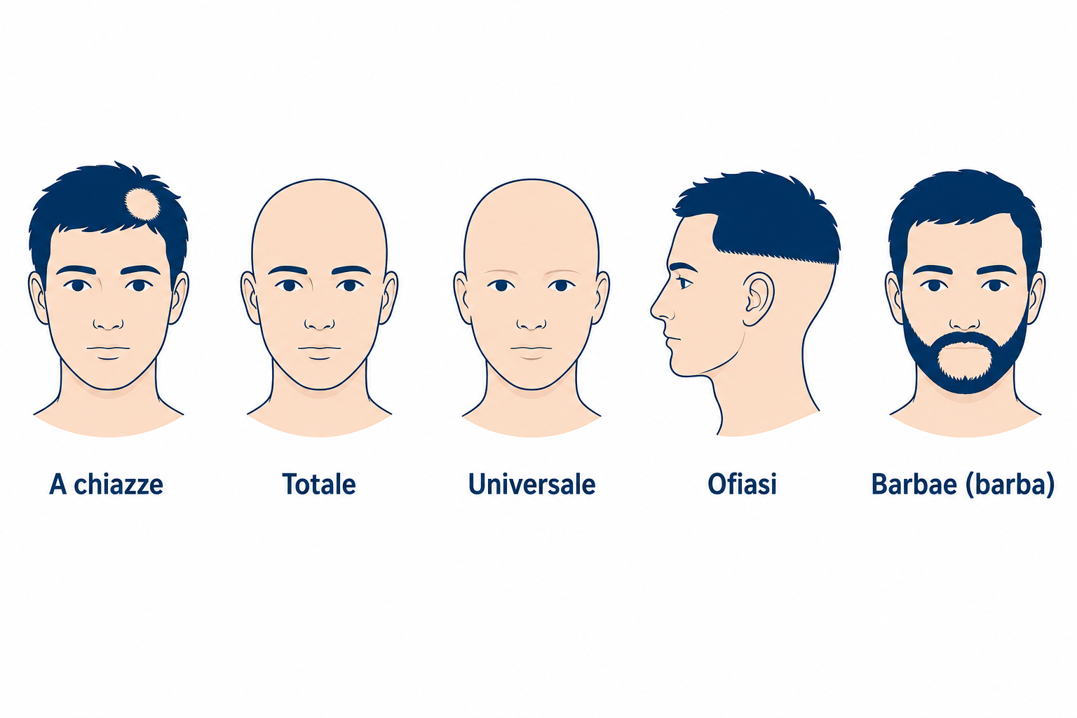 Forme dell'alopecia areata: a chiazze, totale, universale, ofiasi e barbae