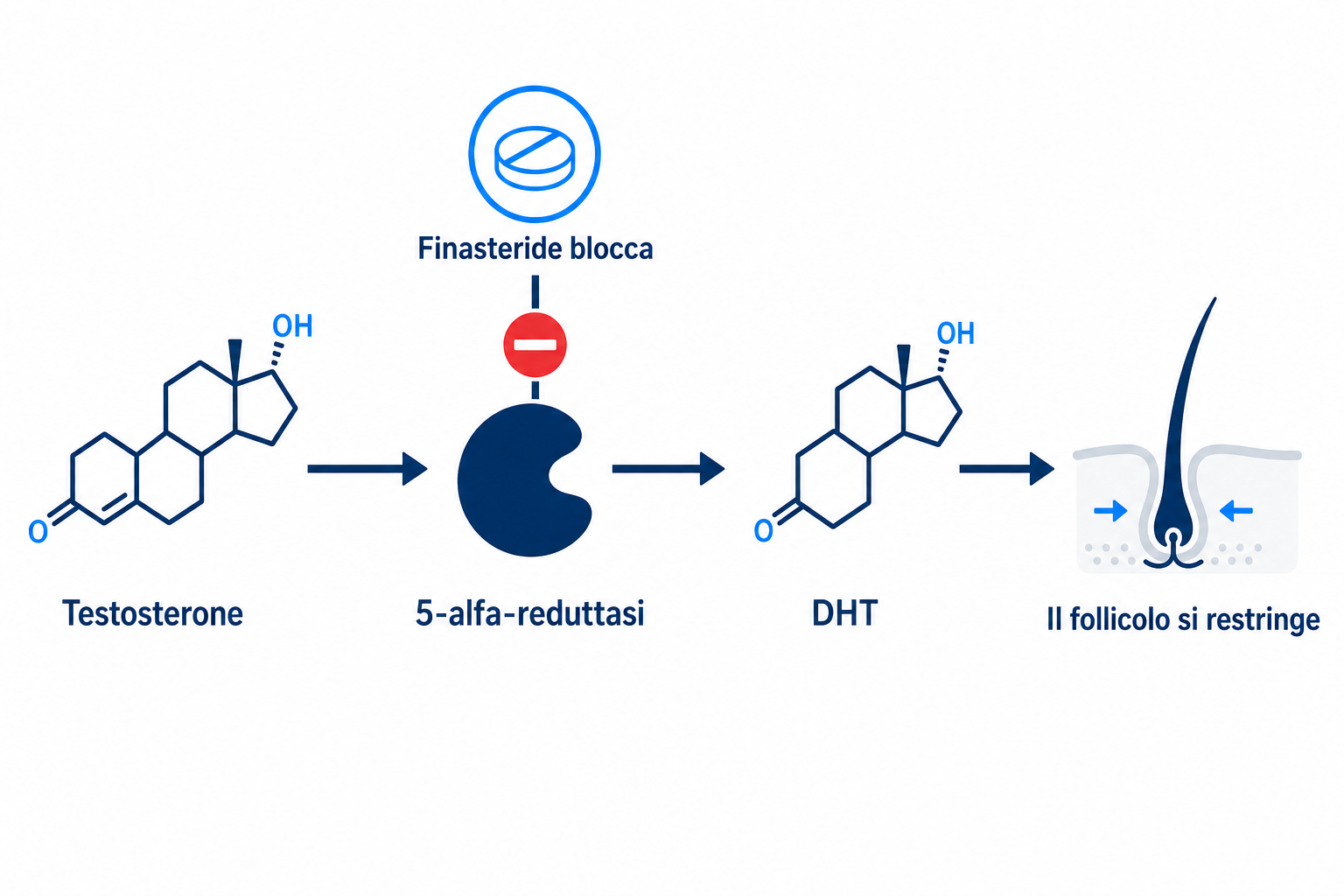 Diagramma del meccanismo d'azione della finasteride: la finasteride blocca la 5-alfa-reduttasi e riduce il DHT