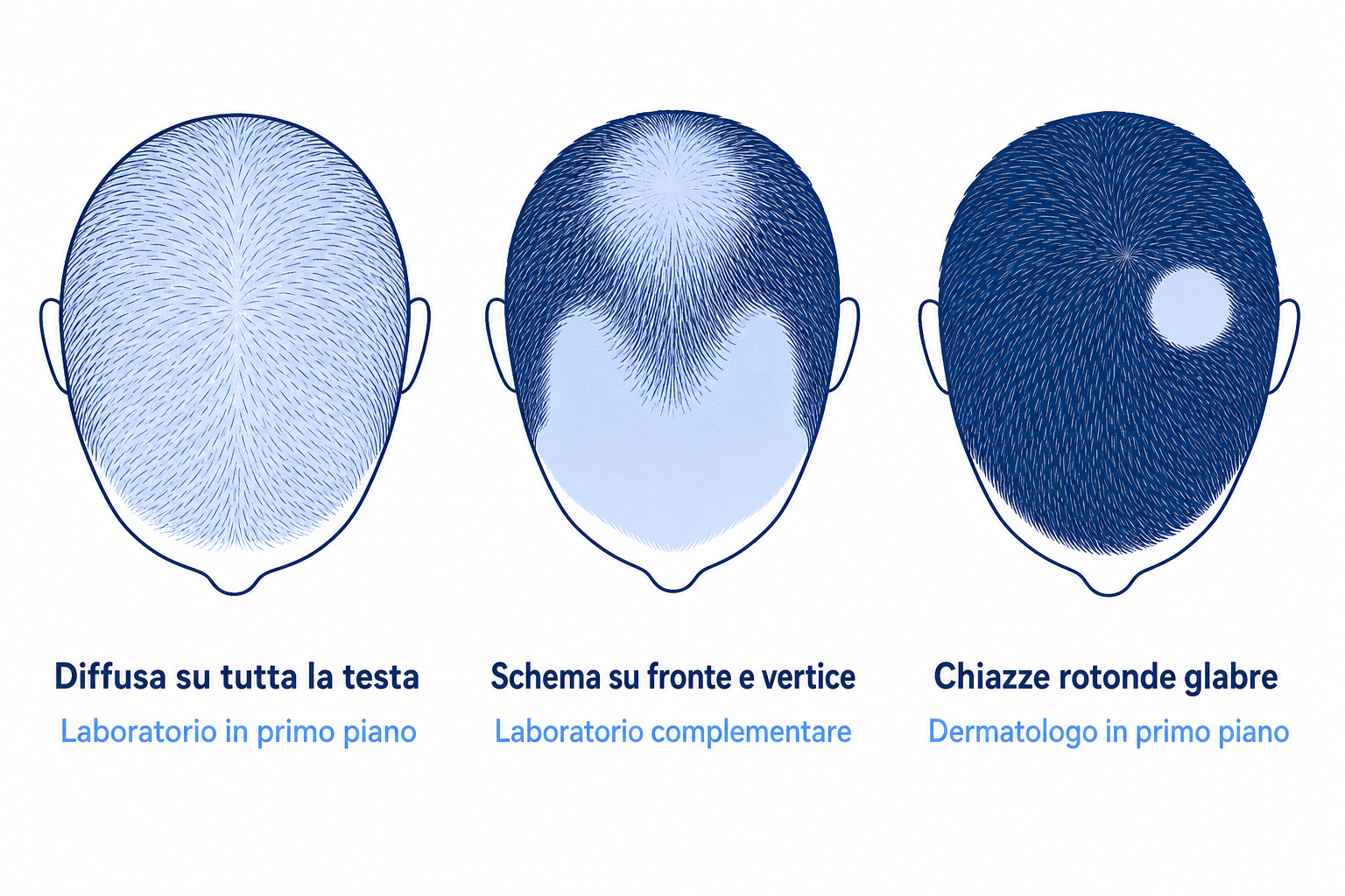 Tre schemi di caduta visti dall'alto: diffusa, schema su fronte e vertice, chiazze rotonde glabre