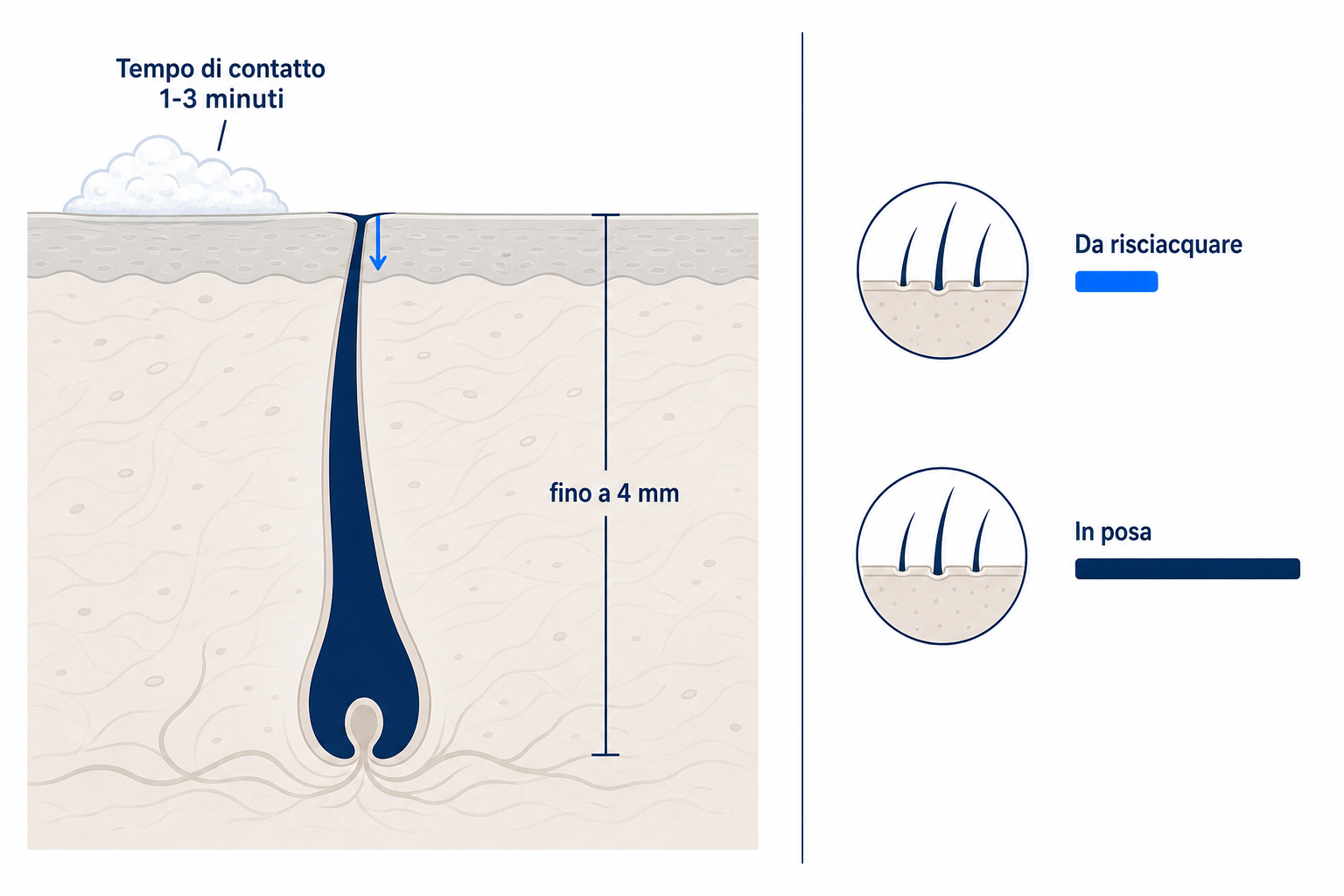 Diagramma: sezione del cuoio capelluto con follicolo pilifero fino a 4 mm di profondità e il breve tempo di contatto di uno shampoo, da 1 a 3 minuti, a confronto tra prodotto da risciacquare e prodotto che resta in posa